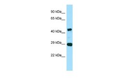 actin, gamma 2 Rabbit anti-Human, Polyclonal, Novus Biologicals 0.1ml;